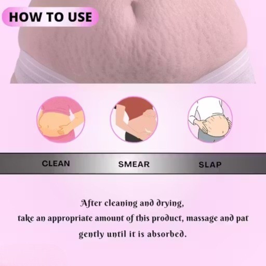 Stretch Mark Removal Cream 60ml Almond Nourishing Formula - Image 4